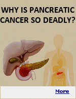 The earlier pancreatic cancer is caught, the better a person�s chance of survival. But most patients don�t have symptoms of pancreatic cancer in early stages. Only 10-15% of patients are diagnosed when cancer is just in the pancreas and may be removed by surgery. It is often discovered after the cancer has spread, when patients have symptoms such as jaundice, pain, and weight loss. Currently, there is no way to screen for pancreatic cancer.